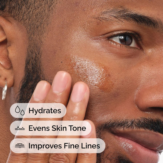 Retinol 1% in Squalane - US 2352