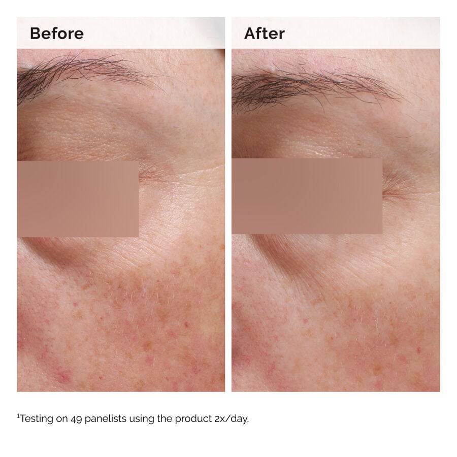 Niacinamide 5% Face and Body Emulsion - US 4562
