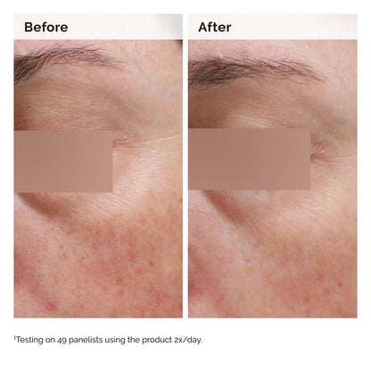 Niacinamide 5% Face and Body Emulsion - US 4562