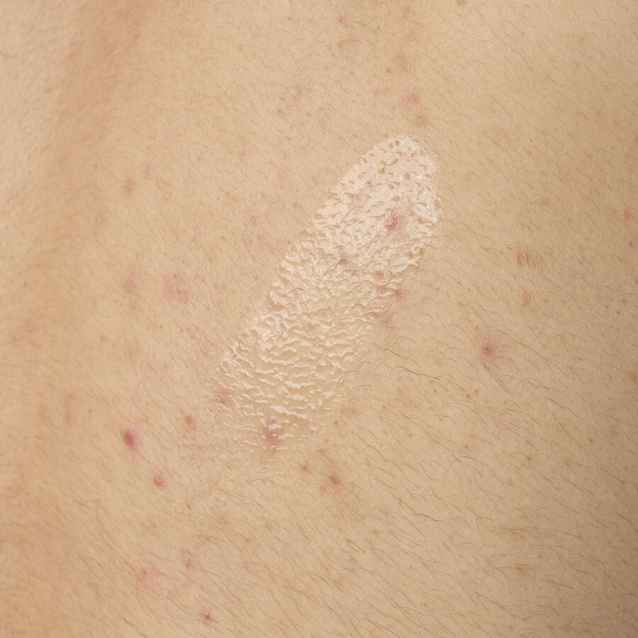 Salicylic Acid 0.5% Body Serum - US 7752