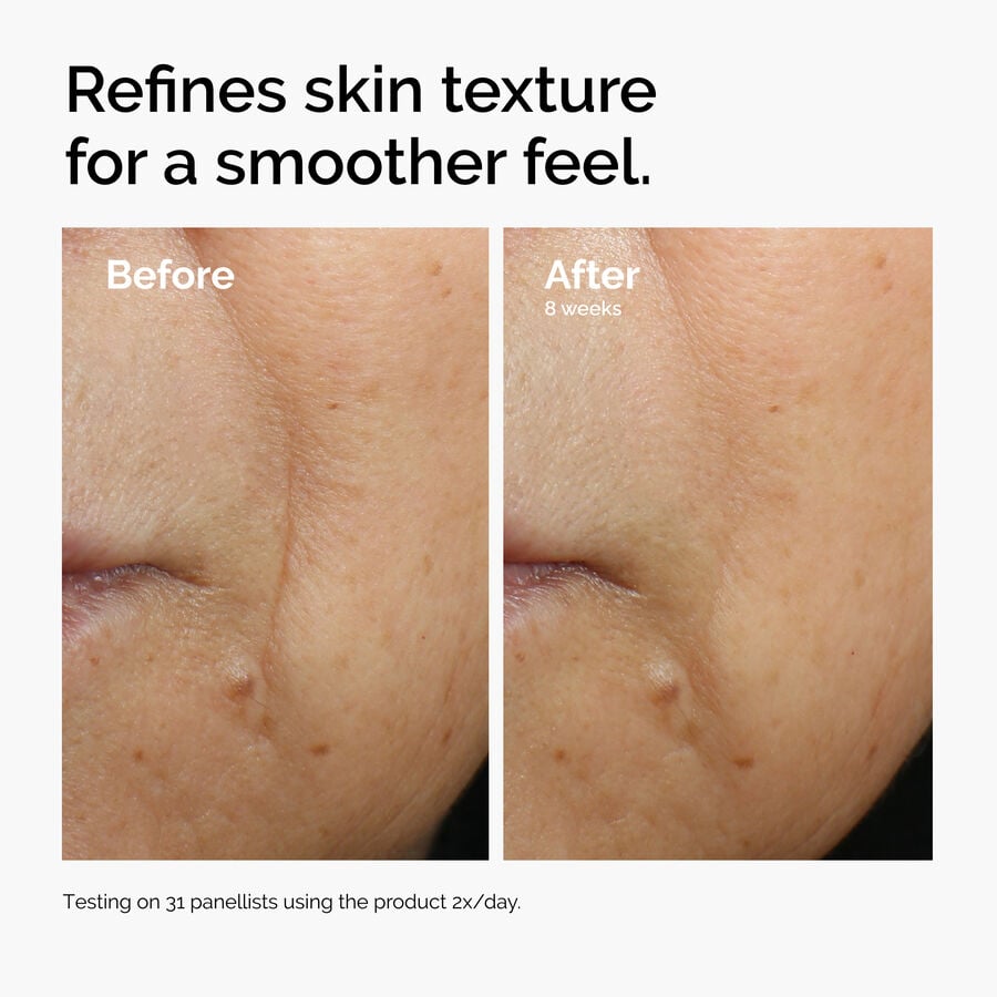 Caffeine 3% + Escin 1% Face Serum - US 7547