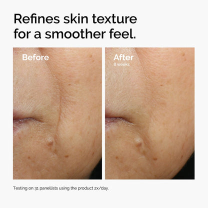 Caffeine 3% + Escin 1% Face Serum - US 7547