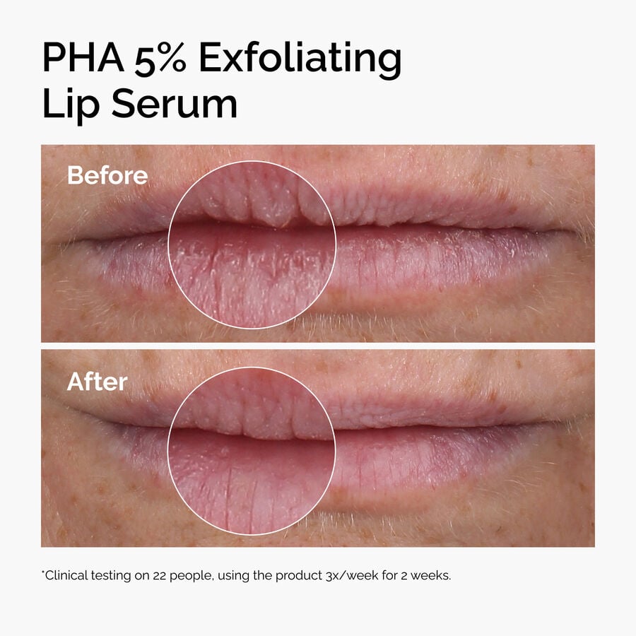 PHA 5% Exfoliating Lip Serum - US 9473
