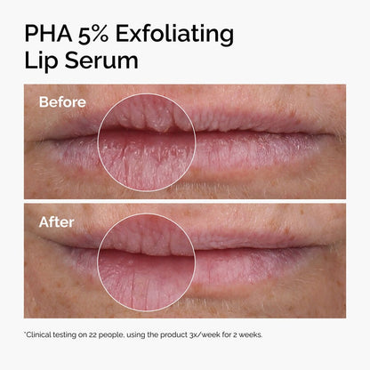 PHA 5% Exfoliating Lip Serum - US 9473